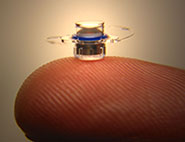 Telescopic Surgery for Macular Degeneration